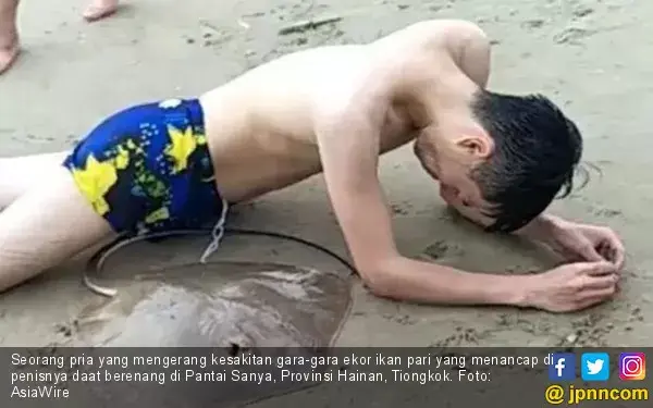 Adududu Sakitnya, Anu Pria Ini Tersengat Ikan Pari