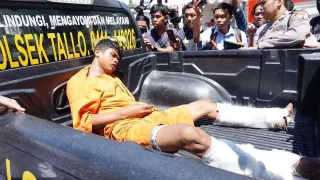 Melawan Petugas, Begal Sadis yang Potong Tangan Korbannya Ditembak Kakinya