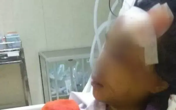 Jari Kaki Korban Begal Sadis Terpaksa Diamputasi