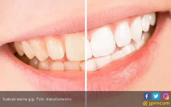 Tujuh Buah untuk ini Bisa Menjaga Kesehatan Gigi