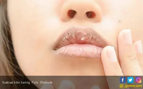 Atasi Bibir Kering di Musim Panas dengan Lip Balm