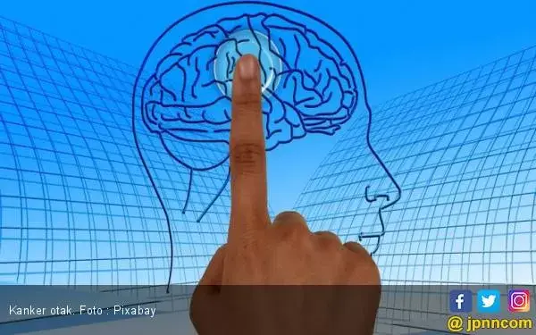 Waspada ! Kanker Otak Kini Serang Kalangan Muda