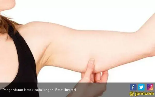 Sedot Lemak Bukan Prosedur untuk Mengurangi Berat Badan