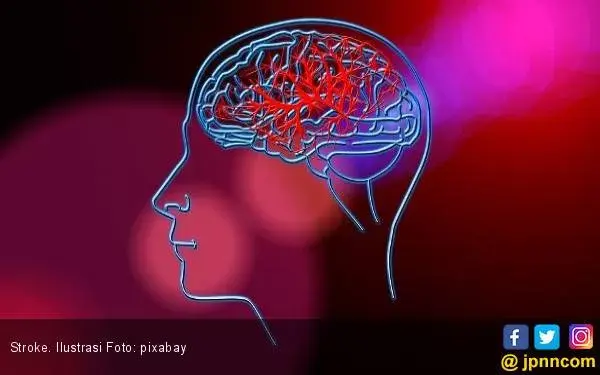 Jauhi Makanan ini jika tak Ingin Kena Stroke