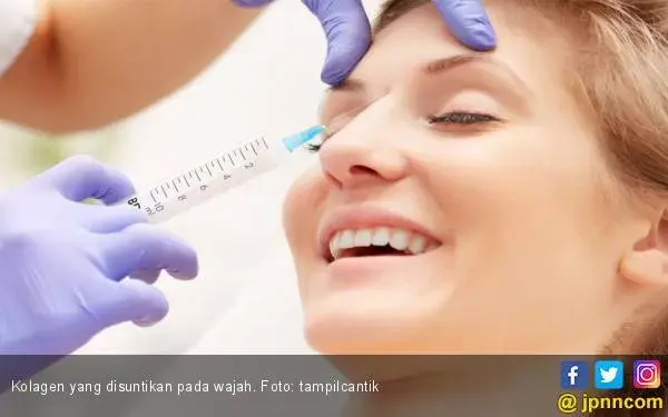 Suntik Antikeriput, Aman atau Berbahaya?