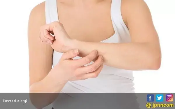 Empat Cara Mengatasi Alergi