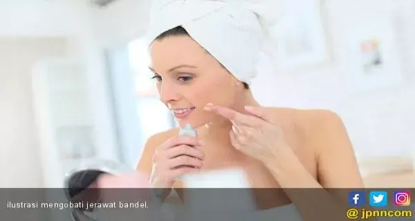 Tiga Cara Sederhana ini Bisa Hilangkan Jerawat Membandel