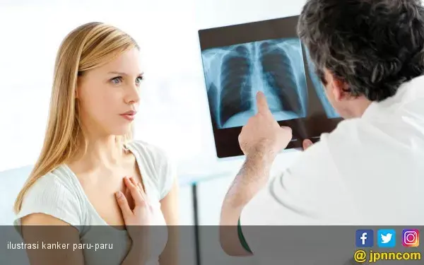 Perlukah Perokok Pasif Rutin Cek Kesehatan Paru?