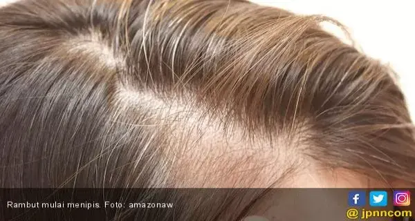 Cek Tingkat Vitamin D di Tubuh dari Rambut