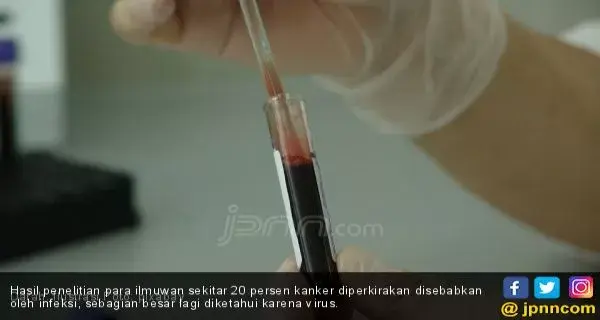 Konsumsi Makanan Antibakteri Ini untuk Mencegah Kanker