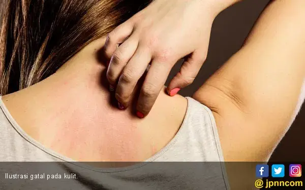 Lima Cara Mencegah Alergi Pada Bahan Pakaian