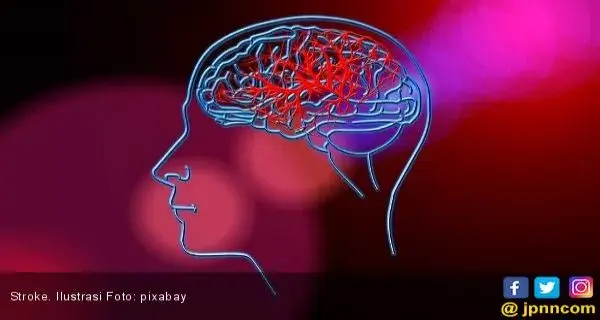 Vaping dan Merokok Dapat Meningkatkan Risiko Stroke