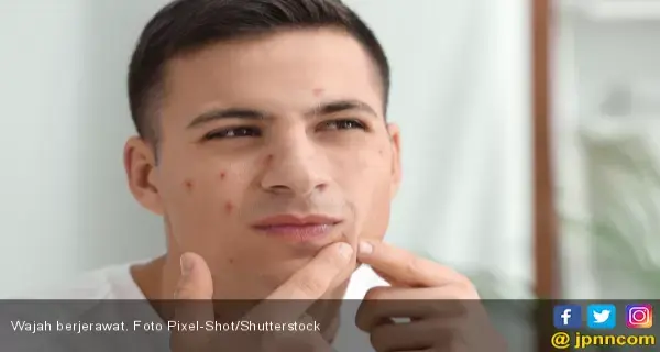 Ketahui Lima Hal Seputar Mitos dan Fakta Bekas Jerawat
