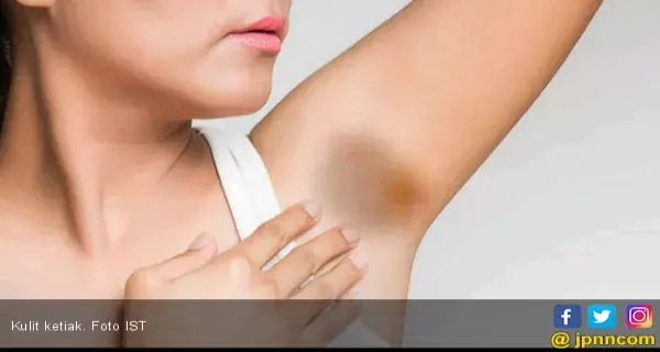 Amankah Memutihkan Kulit Ketiak di Salon Kecantikan?