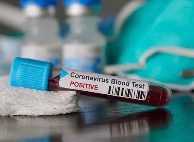 Dua Teori Penyebab Pasien Sembuh Covid-19 Bisa Positif Lagi