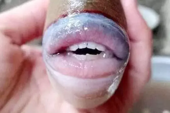 Ikan Mirip Gigi dan Bibir Manusia Viral di Malaysia