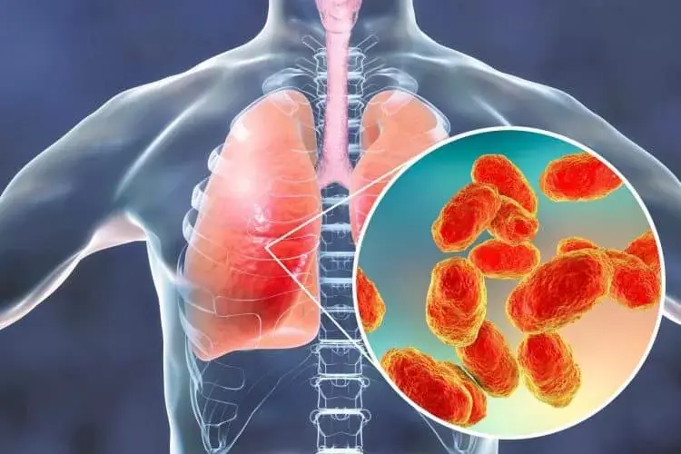 Kazakhstan Bantah Kemunculan Pneumonia Aneh