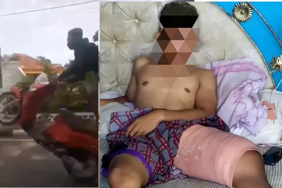 Viral Motor Terbang, Pengendara Patah Tulang