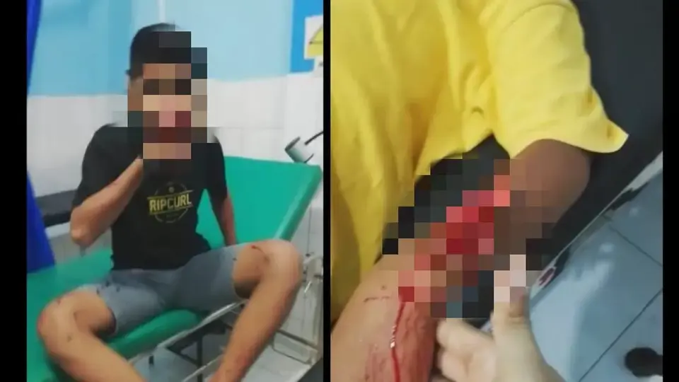 Dua Remaja Di Baubau Dibacok Orang Tak Dikenal, Polisi: Kita Sementara Lakukan Pemeriksaan Saksi-saksi