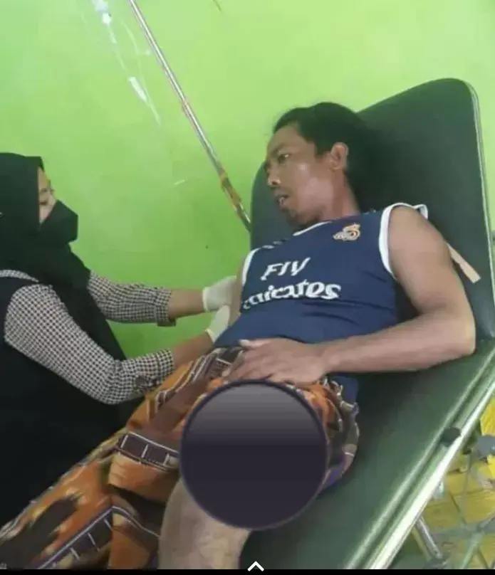 Selang Tiga Hari, Warga Lasalimu Kembali Diterkam Buaya