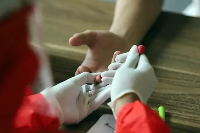 Mengenal Perbedaan Tes Darah dan Widal untuk Diagnosis Sakit Tifus