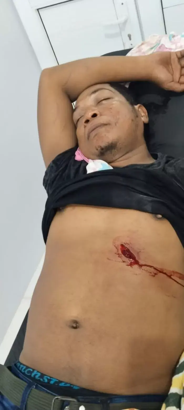 Acara Joget Berujung Penikaman, Korban Dipukul dan ditikan