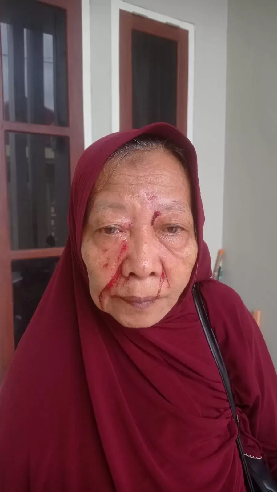 Seorang Lansia Diduga Dianiaya Gegara Jual Beli Emas